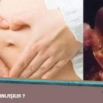 Gebeliğin Başlangıcı Nasıl Anlaşılır ?
